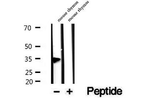 Western blot analysis of extracts of mouse thymus tissue, using PHF11 antibody. (PHF11 antibody  (C-Term))