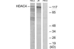 Western blot analysis of extracts from HeLa/Jurkat cells, using HDAC4 (Ab-632) antibody. (HDAC4 antibody  (Ser632))