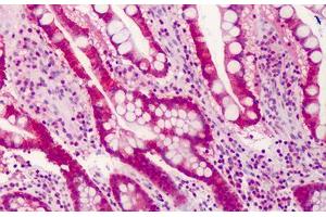 Human Small Intestine: Formalin-Fixed, Paraffin-Embedded (FFPE) (TRAF3 antibody  (C-Term))
