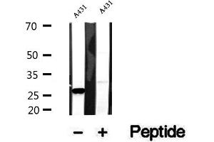 Western blot analysis of extracts of A431 cells, using CHCHD3 antibody. (CHCHD3 antibody  (N-Term))