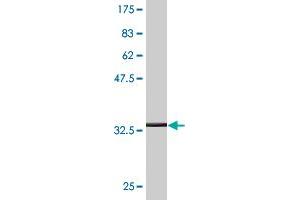 Western Blot detection against Immunogen (36. (PGK1 antibody  (AA 321-417))