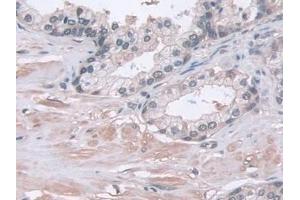 Detection of PSMa5 in Human Prostate Tissue using Polyclonal Antibody to Proteasome Subunit Alpha Type 5 (PSMa5)