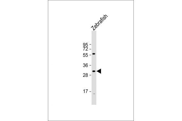HOXD11 Antikörper  (AA 128-155)