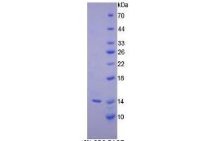 SDS-PAGE (SDS) image for Inhibin, beta C (INHBC) ELISA Kit (ABIN6574159)