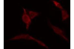 ABIN6274157 staining HuvEc cells by IF/ICC. (Homeobox C6 antibody  (N-Term))