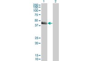 Western Blot analysis of SERPINE1 expression in transfected 293T cell line by SERPINE1 monoclonal antibody (M01), clone 3F2.