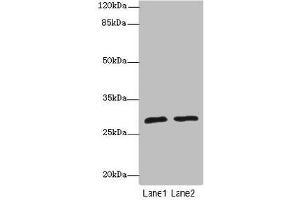Western blot All lanes: APIPantibody at 1. (APIP antibody  (AA 1-242))