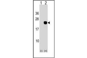 Western blot analysis of DCTD (arrow) using DCTD Antibody (N-term) Cat. (DCMP Deaminase (DCTD) (AA 1-30), (N-Term) antibody)