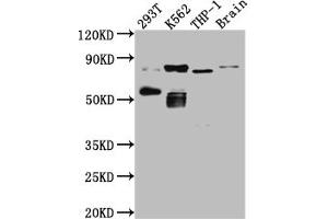 Western Blot Positive WB detected in: 293T whole cell lysate, K562 whole cell lysate, THP-1 whole cell lysate, Mouse Brain whole cell lysate All lanes: PKC antibody at 1:1000 Secondary Goat polyclonal to rabbit IgG at 1/50000 dilution Predicted band size: 82, 75, 68 kDa Observed band size: 82, 55 kDa (Recombinant PKC theta antibody)