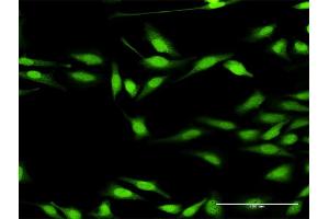 Immunofluorescence of purified MaxPab antibody to DGKZ on HeLa cell. (DGKZ antibody  (AA 1-929))