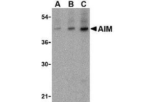 Western blot analysis of AIM in human lymph node tissue lysate with AP30035PU-N AIM antibody at (A) 1, (B) 2 and (C) 4 μg/ml.