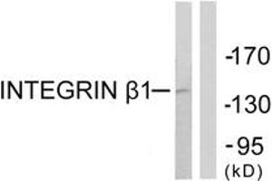 Western blot analysis of extracts from Jurkat cells, using Integrin beta1 (Ab-789) Antibody. (ITGB1 antibody  (AA 746-795))
