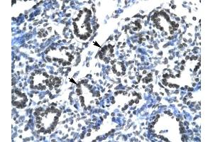 Claudin 17 antibody was used for immunohistochemistry at a concentration of 4-8 ug/ml to stain Alveolar cells (arrows) in Human Lung. (Claudin 17 antibody  (Middle Region))