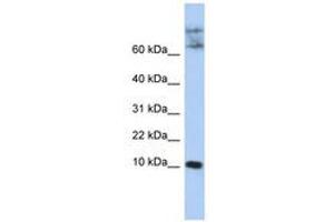 Image no. 1 for anti-Chemokine-Like Factor (CKLF) (N-Term) antibody (ABIN6741007) (CKLF antibody  (N-Term))