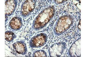 Image no. 1 for anti-serine/threonine Kinase 38 Like (STK38L) (AA 1-281) antibody (ABIN1490700) (STK38L antibody  (AA 1-281))