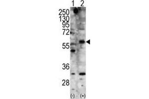 Western blot analysis of STK11 (arrow) using rabbit polyclonal STK11 Antibody .
