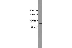 Western Blotting (WB) image for Complement Factor B (CFB) ELISA Kit (ABIN1114331) (Complement Factor B ELISA Kit)