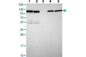 Western blot analysis of ZC3HAV1 polyclonal antibody . (ZC3HAV1 antibody)