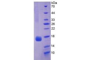 SDS-PAGE of Protein Standard from the Kit  (Highly purified E. (Myoglobin ELISA Kit)