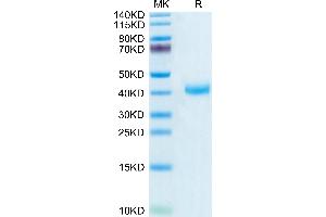 Biotinylated Human CD161 on Tris-Bis PAGE under reduced condition. (CD161 Protein (AA 67-225) (His-Avi Tag,Biotin))