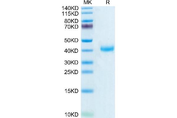 CD161 Protein (AA 67-225) (His-Avi Tag,Biotin)