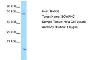 Image no. 1 for anti-Ankyrin Repeat Domain 57 (ANKRD57) (AA 425-474) antibody (ABIN6750152) (ANKRD57 antibody  (AA 425-474))
