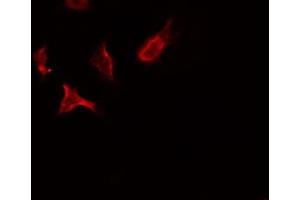 ABIN6275847 staining HeLa by IF/ICC. (STK10-A antibody  (Internal Region))