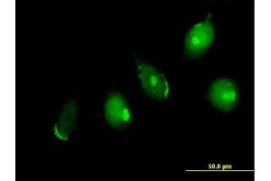 Immunofluorescence (IF) image for anti-Golgin A5 (GOLGA5) (AA 1-731) antibody (ABIN523332)