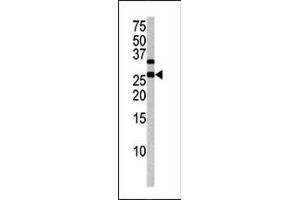 Image no. 1 for anti-Cyclin-Dependent Kinase Inhibitor 1B (p27, Kip1) (CDKN1B) (pThr187) antibody (ABIN358186) (CDKN1B antibody  (pThr187))