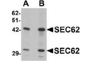 Western blot analysis of SEC62 in rat brain tissue lysate with SEC62 antibody at (A) 0.