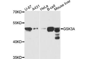 Western blot analysis of extracts of various cell lines, using GSK3A antibody (ABIN5970240) at 1/1000 dilution. (GSK3 alpha antibody)