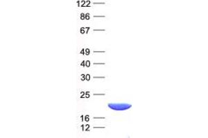 Validation with Western Blot (ARL2BP Protein (His tag))