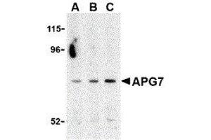 Western Blotting (WB) image for anti-ATG7 Autophagy Related 7 (ATG7) (C-Term) antibody (ABIN2477540) (ATG7 antibody  (C-Term))