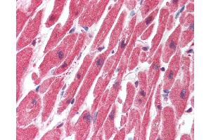 Anti-SERTAD1 antibody IHC of human heart. (SERTAD1 antibody  (N-Term))