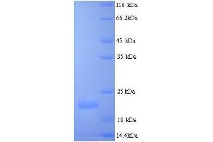 Mismatch Repair Protein 2 (MSH2) (AA 139-311) protein (His tag)
