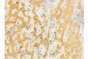 ABIN6262446 and ABIN6278479 at 1/100 staining human normal liver tissue by IHC-P.