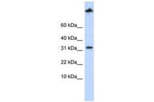 Image no. 1 for anti-Sterol Carrier Protein 2 (SCP2) (AA 144-193) antibody (ABIN6741390)