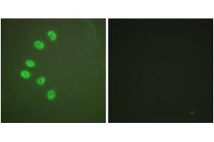 Immunofluorescence analysis of A549 cells, using Progesterone Receptor (Ab-294) Antibody.