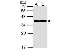 WB Image Sample (30 ug of whole cell lysate) A: Molt-4 , B: Raji 12% SDS PAGE antibody diluted at 1:1000 (XBP1 antibody)