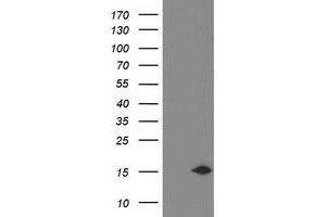 Western Blotting (WB) image for anti-NADH Dehydrogenase (Ubiquinone) 1 alpha Subcomplex, 7, 14.5kDa (NDUFA7) antibody (ABIN1499664)