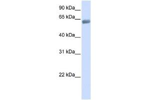SLC47A2 antibody used at 1 ug/ml to detect target protein. (SLC47A2 antibody  (C-Term))