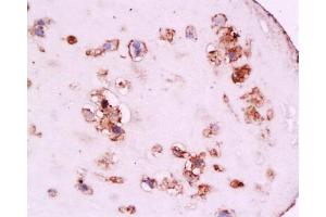 Formalin-fixed and paraffin embedded human placenta tissue labeled with Anti-CD105 Polyclonal Antibody, Unconjugated at 1:200, followed by conjugation to the secondary antibody and DAB staining