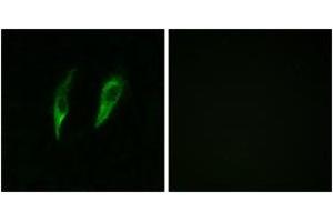 Immunofluorescence analysis of HeLa cells, using IRAK3 Antibody. (IRAK3 antibody  (AA 491-540))