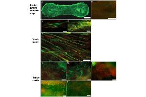 Immunostaining (ISt) image for anti-COL1A2/COL1A1 antibody (ABIN5596819)