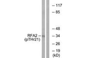 Western blot analysis of extracts from HeLa cells treated with Adriamycin 0. (RPA2 antibody  (pThr21))