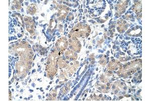 FOXR2 antibody was used for immunohistochemistry at a concentration of 2. (FOXR2 antibody  (N-Term))