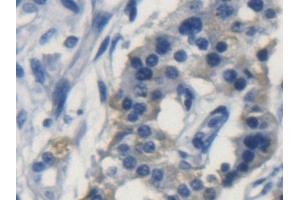 Immunohistochemistry (IHC) image for anti-Apolipoprotein L, 2 (APOL2) (AA 186-337) antibody (ABIN7441058)