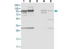 Western blot analysis of Lane 1: RT-4, Lane 2: U-251 MG, Lane 3: Human Plasma, Lane 4: Liver, Lane 5: Tonsil with SCARF2 polyclonal antibody  at 1:250-1:500 dilution.