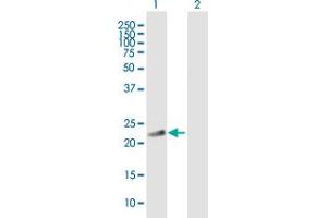 Western Blot analysis of PDE4DIP expression in transfected 293T cell line by PDE4DIP MaxPab polyclonal antibody. (PDE4DIP antibody  (AA 1-177))