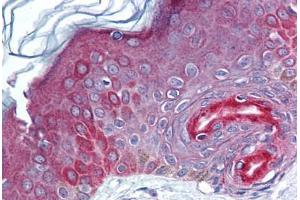 Human Skin (formalin-fixed, paraffin-embedded) stained with FAM3C antibody ABIN293839 at 5-10 ug/ml followed by biotinylated goat anti-rabbit IgG secondary antibody ABIN481713, alkaline phosphatase-streptavidin and chromogen. (FAM3C antibody  (AA 40-80))